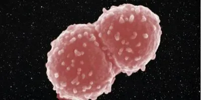 Deinococcus radiodurans