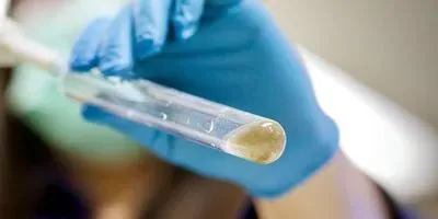 Zobellella denitrificans ZD1 bacteria