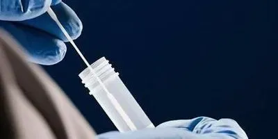 Teknova completes FDA notification for room temperature-stable viral transport medium