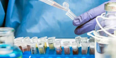 testing wastewater for SARS-CoV-2