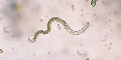 Photograph of Toxocara parasite known to infect dogs