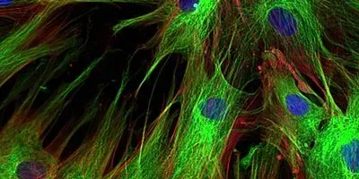 fibroblasts are one of the cell types researchers used in hydrogels
