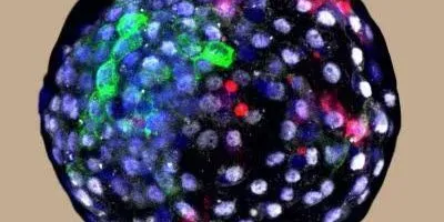 Human-monkey chimeric blastocyst (article image)