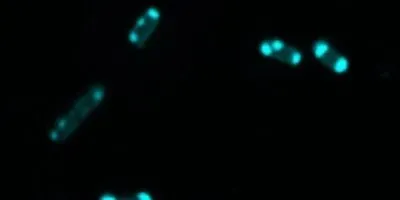 Chemical probe signaling antibiotic resistance risk