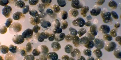 Benthic foraminifer Nonionella stella