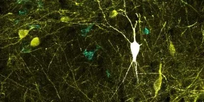 Inhibitory neuron