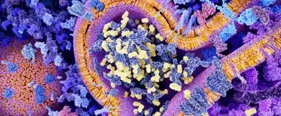 Overcoming the challenges of cell therapy manufacturing (hero image)