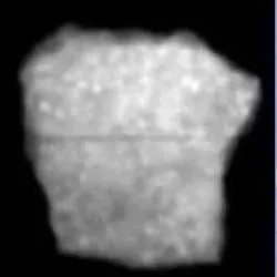 Images of rocks in an xray