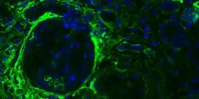 Image of a cell