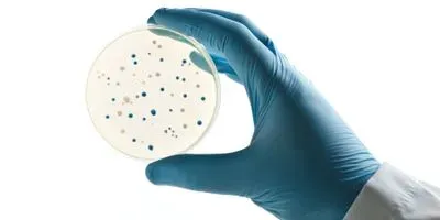 Researcher holding a petri dish filled with bacteria