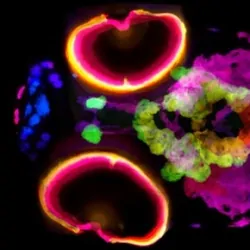 Melanin is visualized in a silver-stained, 5-day-old zebrafish using X-ray histotomography. The different colors were assigned based on the depth of the melanin in cells within the sample from top to bottom.