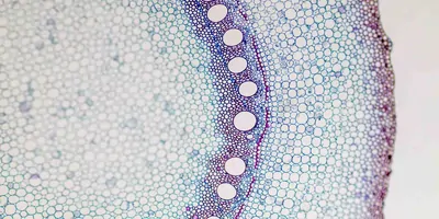 Image of a plant stem cross section under a microscope 