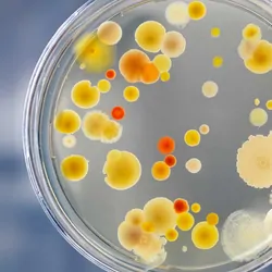 Bacteria growin on a petri dish being held by a gloved hand
