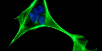 Cells seen through a microscope that are died green