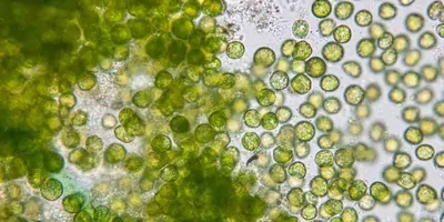 Microscope image of algae