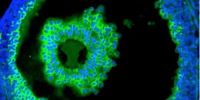 Immuno assay on cells