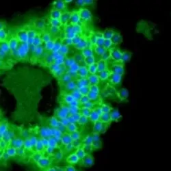 Immuno assay on cells