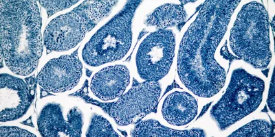 Image of a cell cullture under a microscope