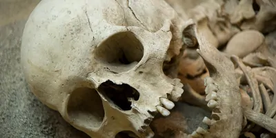Human skull with mouth open lying on its side in the dirt