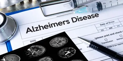 Medical document with "Alzheimers Disease" written on it next to a brain scan