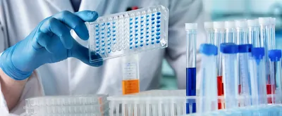 hand of researcher working with microplate for elisa analysis. Doctor working with panel microplate for diseases diagnostic in the laboratory