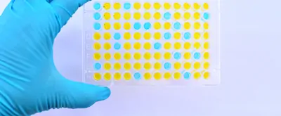 Enzyme-linked immunosorbent assay (ELISA) plate, Immunology testing method in laboratory