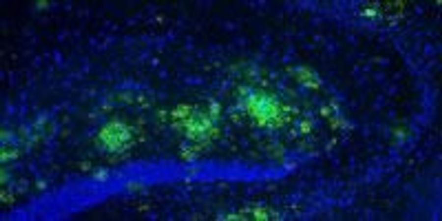 ALOE VERA COMPOUND COULD FIGHT ALZHEIMER S DISEASE visual data 4