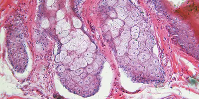 a microscopic close up