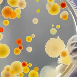 Researcher holding a petri dish with mold growth in it