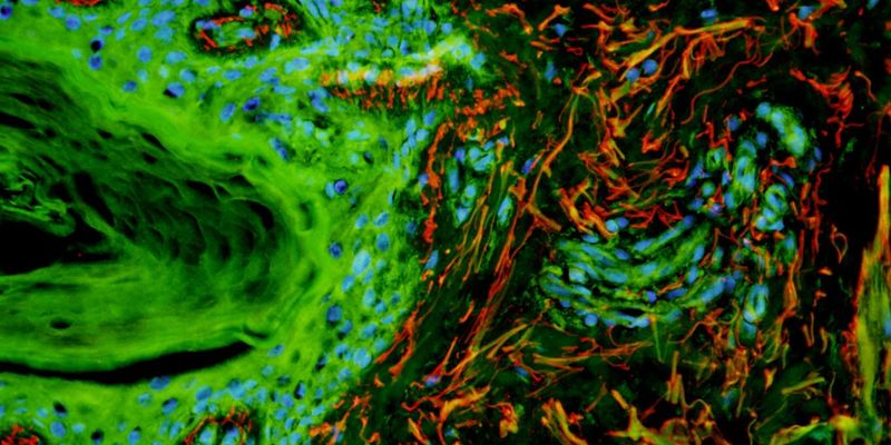 Advancements in LED Tech Transform Fluorescence Microscopy | Lab Manager