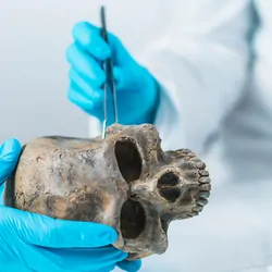 Researchers examining an ancient human skull