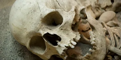 Human skeletal remains