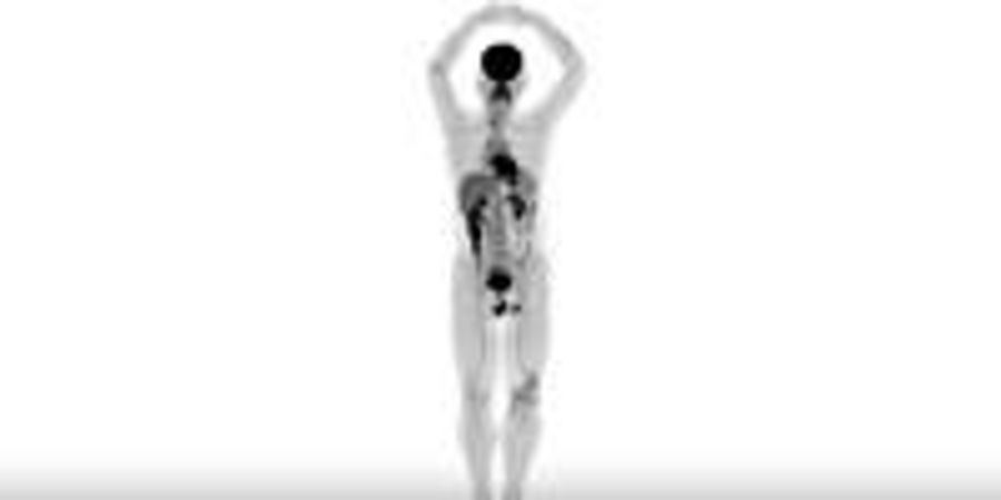 Human Images from the World's First Total-Body Medical Scanner Unveiled ...