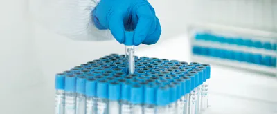 The hand of a young Asian woman holding a test tube in the lab