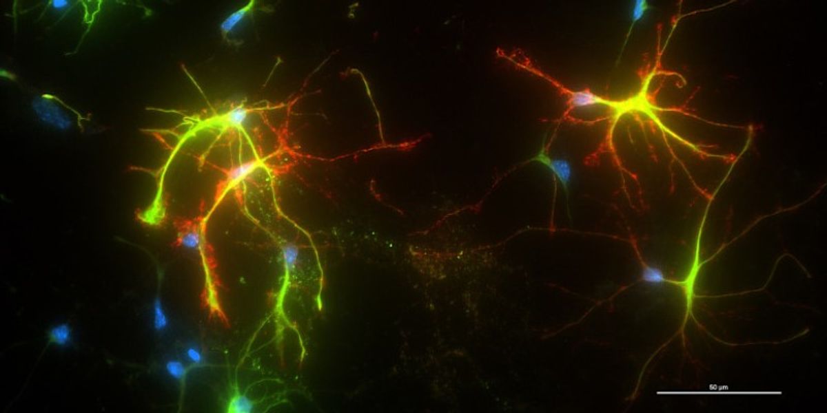 Newly Developed Nanomaterial Mimics the Behavior of Proteins - Vimarsana News