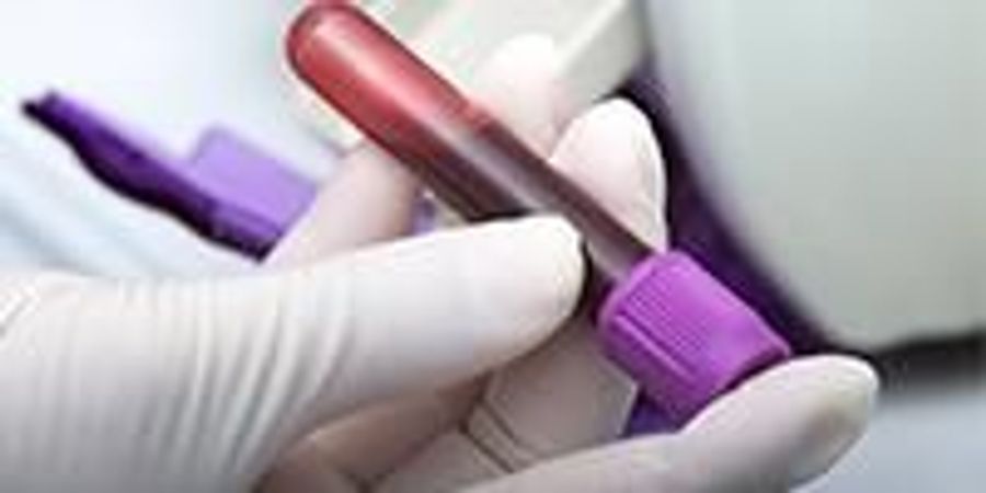 New Blood Test Can Rule Out Heart Attacks Earlier at Point of Care ...