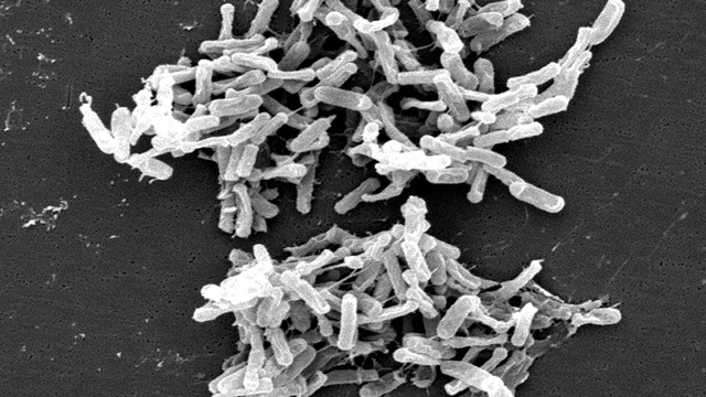 Clostridium-difficile