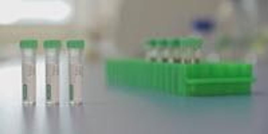 Bio-Rad Announces the Launch of Anti-Ranibizumab Antibodies | Lab Manager