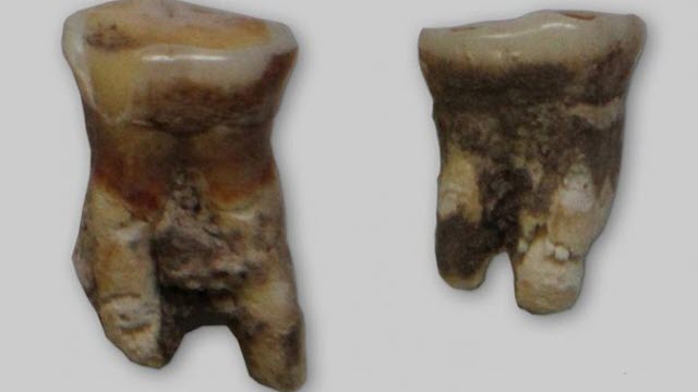 mesolithic-tooth