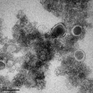 exosomes