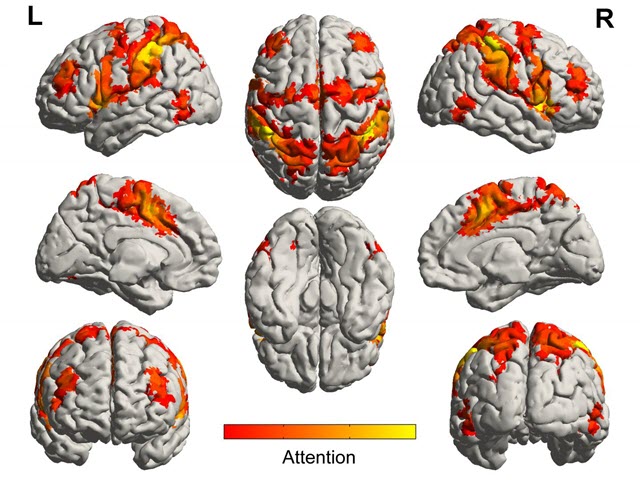 musicbrain