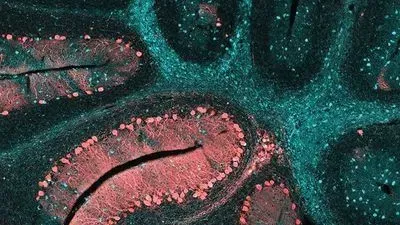 Improving Clinical Specimen Management