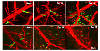 dynamics of tumor cells