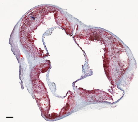 Cross section of an aorta 