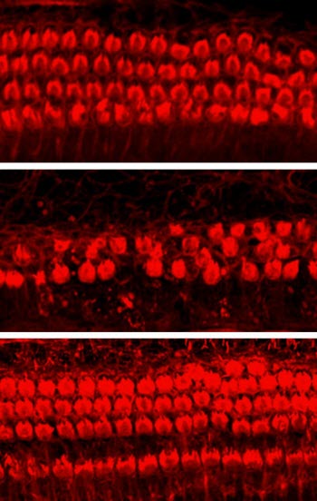 Kenpaullone Protects Cochlear Hair Cells from Cisplatin