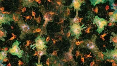 INSIGHTS on Live Cell Imaging
