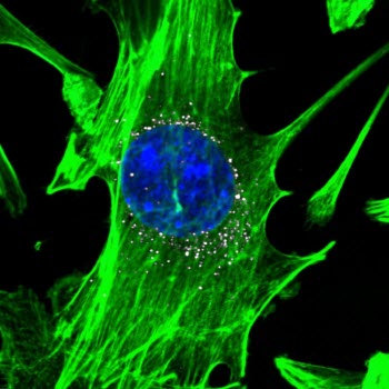 Cells, stained in green with blue nuclei