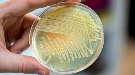 yeast strain in a petri dish