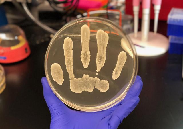 S. epidermidis growing on an agar plate.