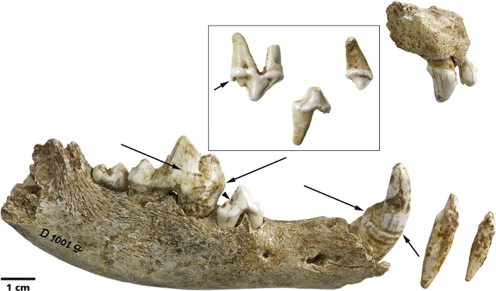 Puppy Teeth with Canine Distemper Traces 